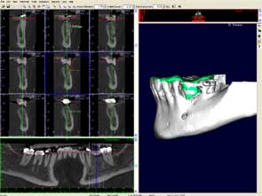 Dental Imaging