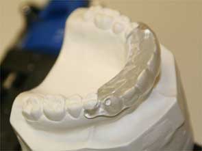 Invisalign