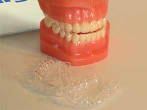 Invisalign