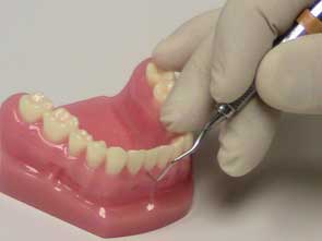 Non Surgical Gum Treatment