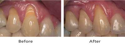 Restorative Dentistry